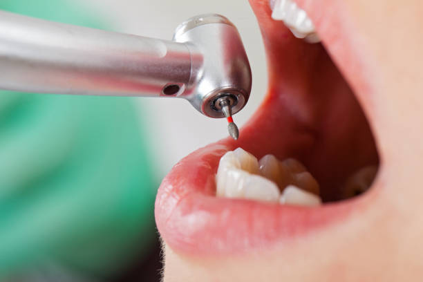 Best Weekend Emergency Dentist in Markesan, WI